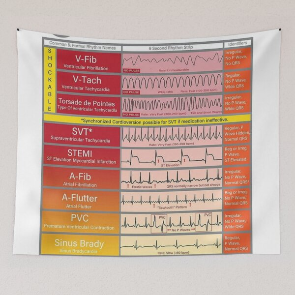 Item preview, Ecg Ekg basics Knowledge  designed and sold by Weird-Artss.