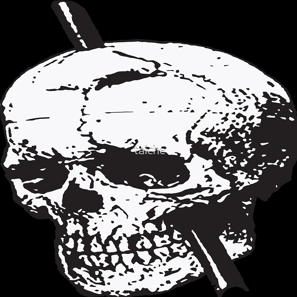 "Black and White Skull of Phineas Gage With Tamping Iron Vector" by