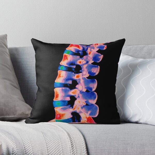 Degenerative Disc Disease, Mri Throw Pillow