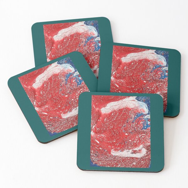 Item preview, art phone case bliss and natural Graphic  designed and sold by stanbase.