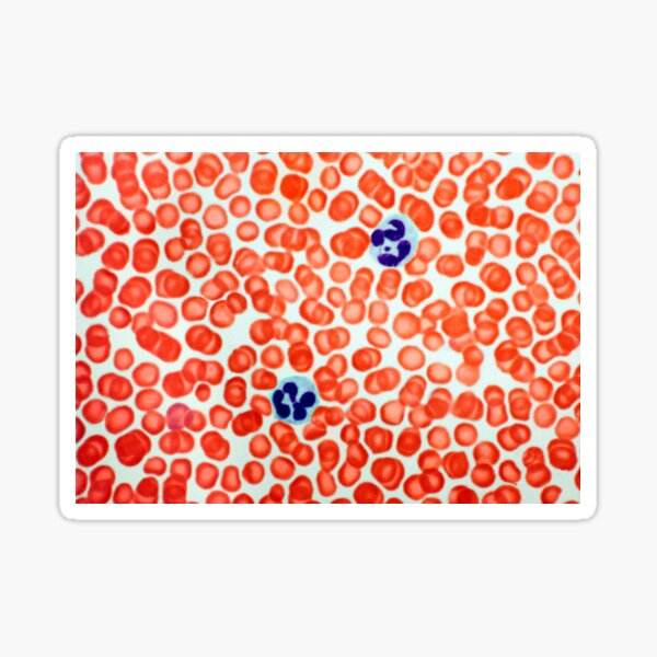 Item preview, Human blood cells, light micrograph (P242/0455) designed and sold by SciencePhoto.