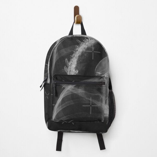 Item preview, Alien radiography, Alien X-ray designed and sold by CurtisMurphyjhj.