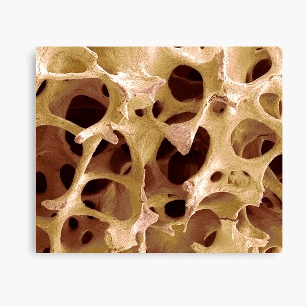 Aperçu de l'œuvre Tissu osseux, MEB (F001/3050) créée et vendue par SciencePhoto.