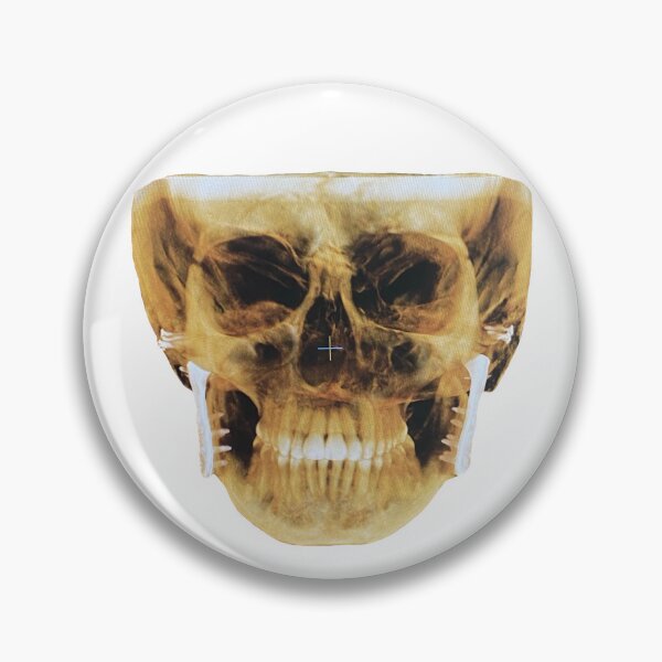 Item preview, Jaw joint X-ray  designed and sold by Panda-003.