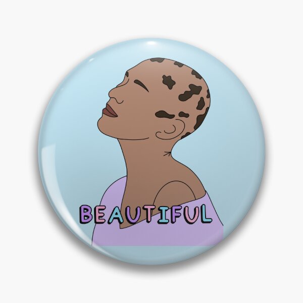 Item preview, Alopecia: Embrace Your Beauty, Bestowed with Resilience designed and sold by Aswood25.