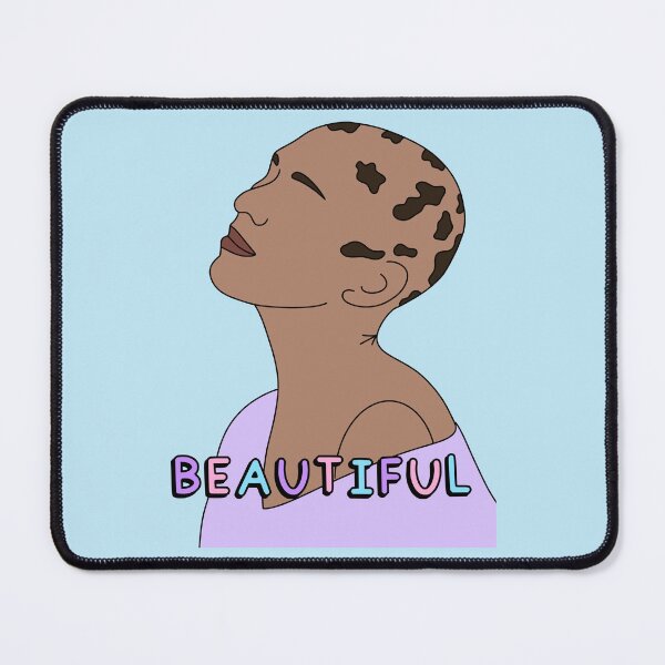 Item preview, Alopecia: Embrace Your Beauty, Bestowed with Resilience designed and sold by Aswood25.
