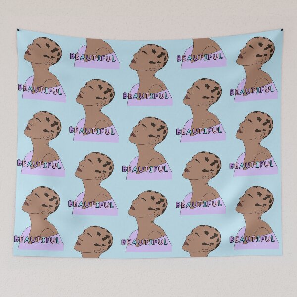 Item preview, Alopecia: Embrace Your Beauty, Bestowed with Resilience designed and sold by Aswood25.