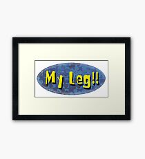 My Leg! Framed Print