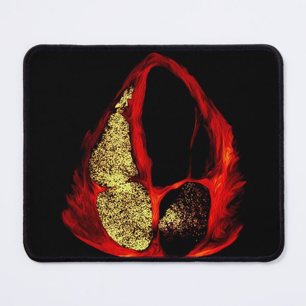 Item preview, Bubbles PFO Gold edition designed and sold by EchoArtUK.