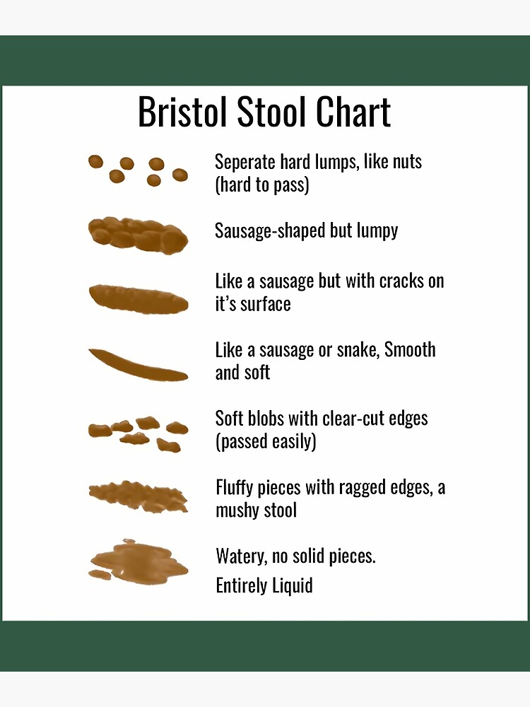 Bristol Stool Chart bristol-stool-chart-art-print-for-sale-by-rhguoezpmi4-redbubble
