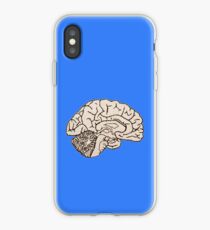 hemisected brain iPhone Case