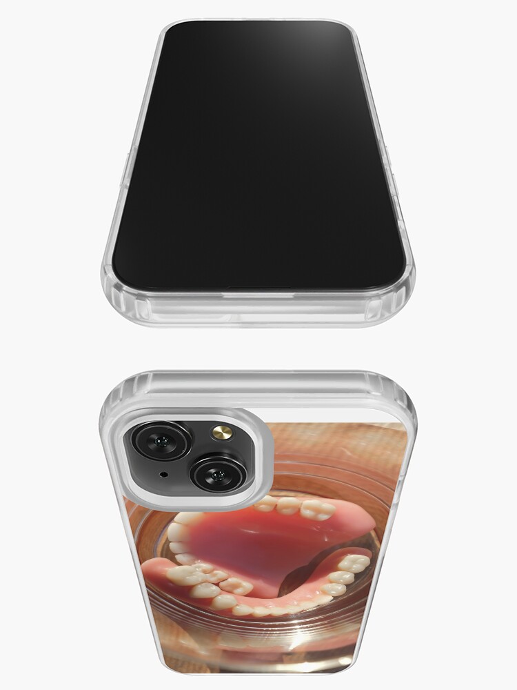 denture jaw gum iPhone Case