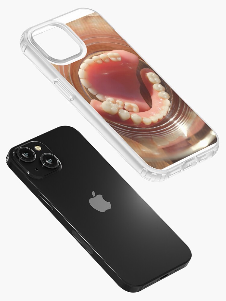 denture jaw gum iPhone Case