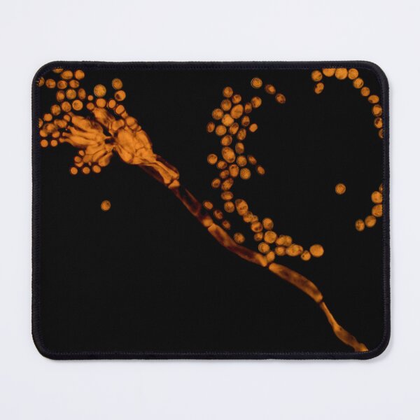 Item preview, Penicillium mold under the microscope designed and sold by SDym Photography.