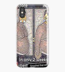 Smash that MF like button iPhone Case
