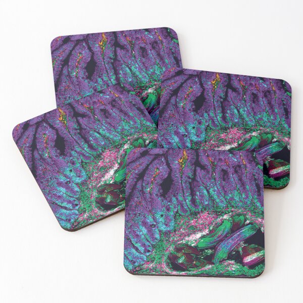 Item preview, Intestinal Fortitude: Joker designed and sold by DreamingBeetle.