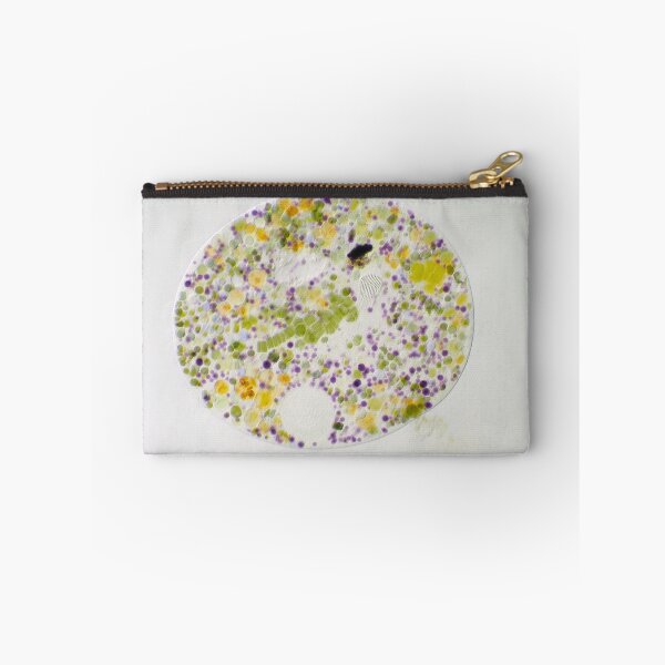 Item preview, Nassulid ciliate - an unicellular ciliate that feeds on filamentous blue-green algae designed and sold by SDym Photography.