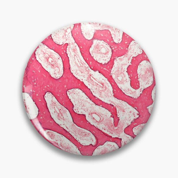 Item preview, Spongy Bone designed and sold by Love Histology.