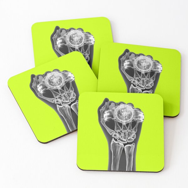 Item preview, Hand and watch under x-ray Radiographer   Hand under x-ray ghosth Halloween poo  MEDICAL CANNABIS UNDER X RAY Throw Pillow fanny bones xray  bones  Halloween   fanny hand x-ray   designed and sold by 4xF.