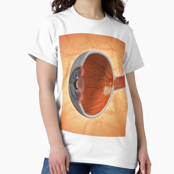 Item preview, Retinal Implant designed and sold by Equinox Graphics.