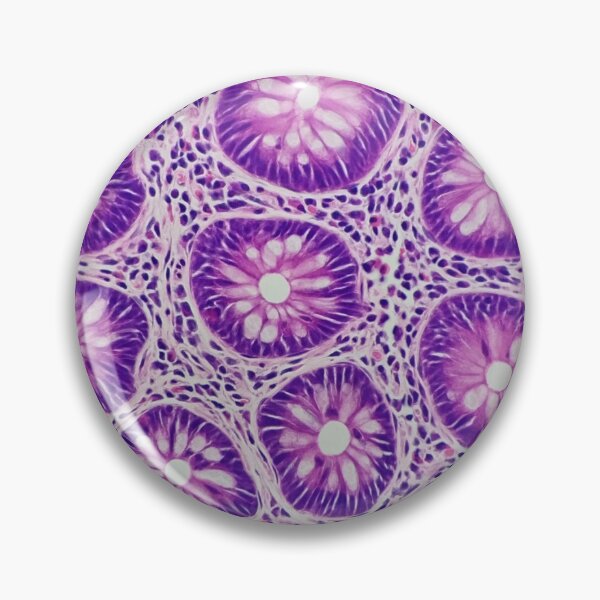 Item preview, Large bowel histology, 400x, H&E, squared  designed and sold by Psymier.