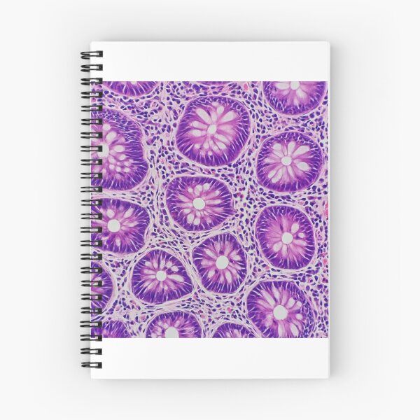 Item preview, Large bowel histology, 400x, H&E, squared  designed and sold by Psymier.
