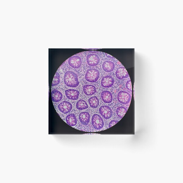 Item preview, Large bowel histology,  400x, H&E designed and sold by Psymier.