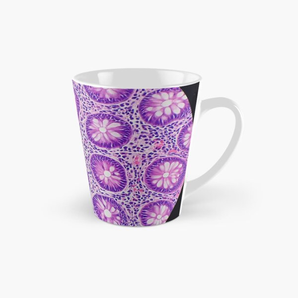 Item preview, Large bowel histology,  400x, H&E designed and sold by Psymier.
