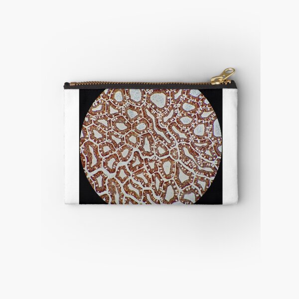 Item preview, Histology of small bowel, cytokeratin immunohistochemistry,100x designed and sold by Psymier.
