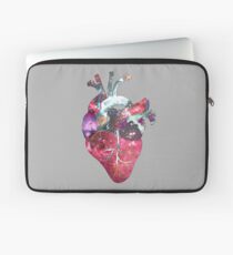Superstar Heart (on grey) Laptop Sleeve
