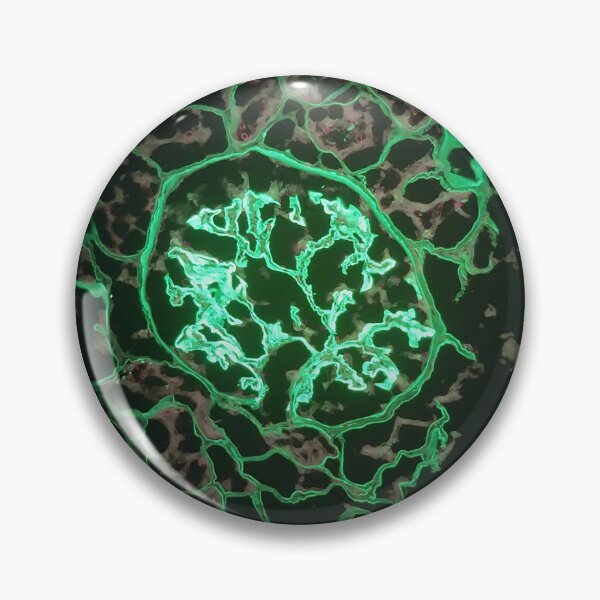 Item preview, IMF glomerulus 400x, ribbon fluorescence designed and sold by Psymier.