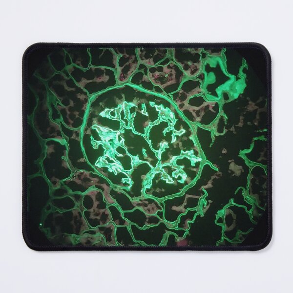 Item preview, IMF glomerulus 400x, ribbon fluorescence  designed and sold by Psymier.