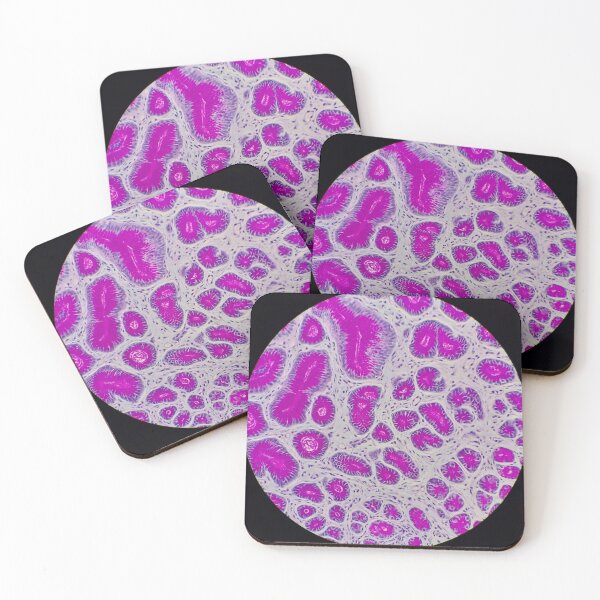 Item preview, Histology of small bowel,  100x, AB/PAS designed and sold by Psymier.