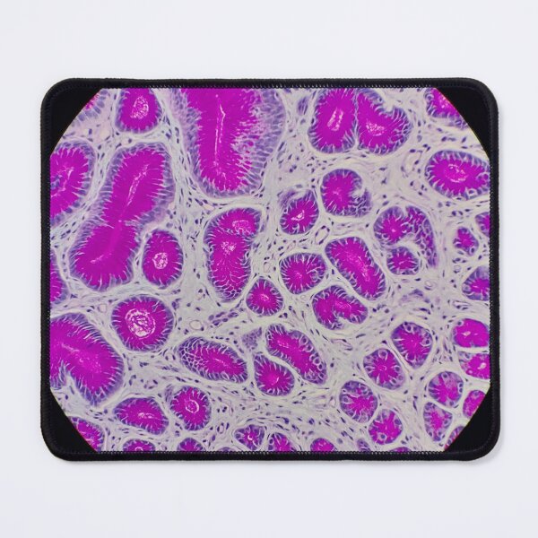 Item preview, Histology of small bowel,  100x, AB/PAS designed and sold by Psymier.