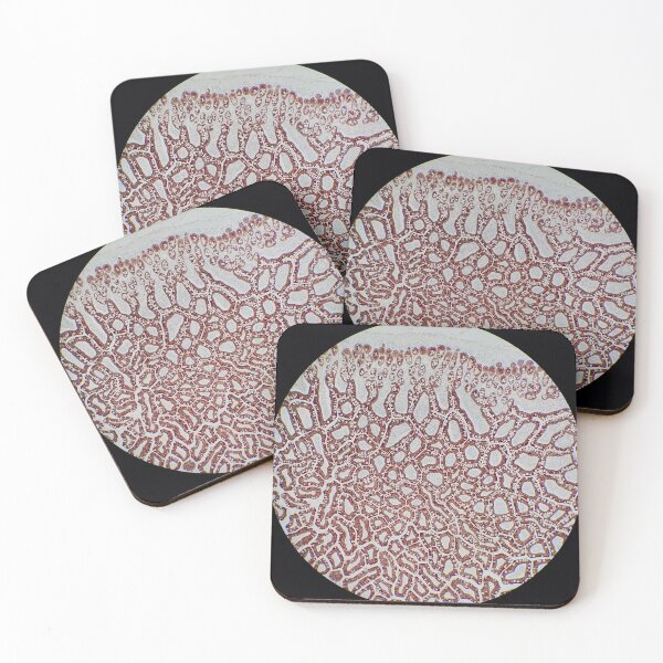 Item preview, Small bowel histology, cytokeratin immunohistochemistry, 100x designed and sold by Psymier.