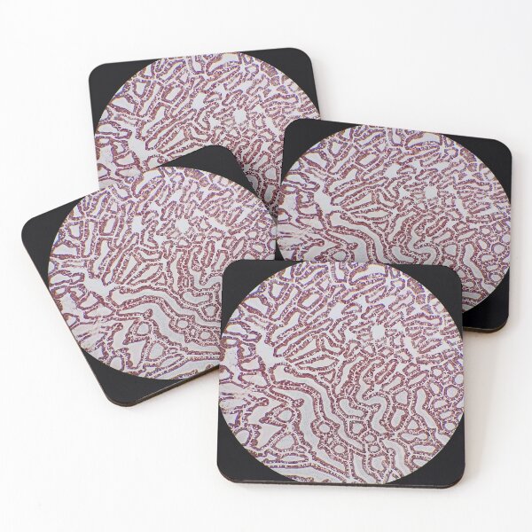 Item preview, Small bowel histology, 40x, cytokeratin immunohistochemistry designed and sold by Psymier.
