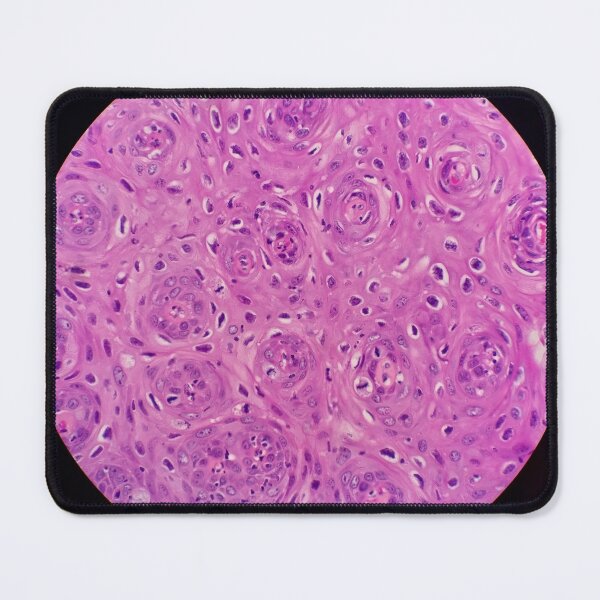 Item preview, Histology of squamous epithelium, 100x, H&E designed and sold by Psymier.