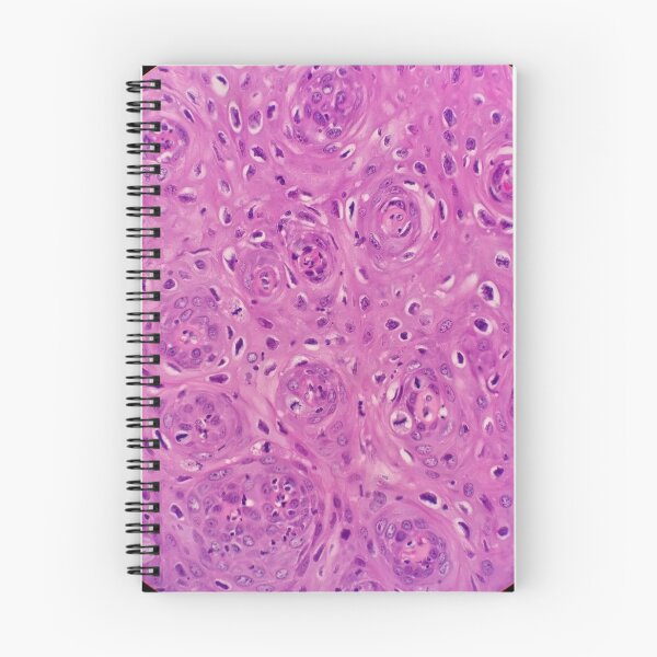 Item preview, Histology of squamous epithelium, 100x, H&E designed and sold by Psymier.