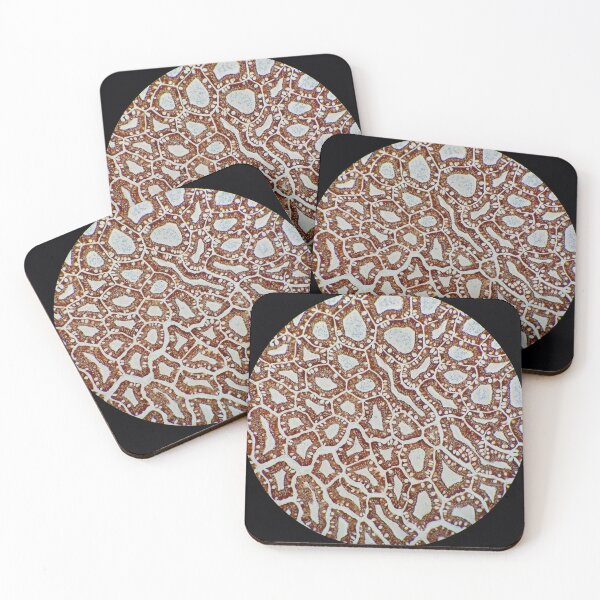 Item preview, Histology of small bowel, cytokeratin immunohistochemistry,100x designed and sold by Psymier.