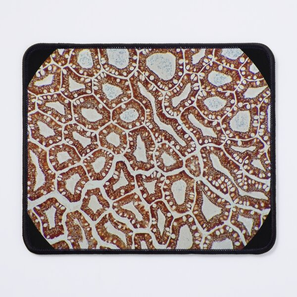 Item preview, Histology of small bowel, cytokeratin immunohistochemistry,100x designed and sold by Psymier.