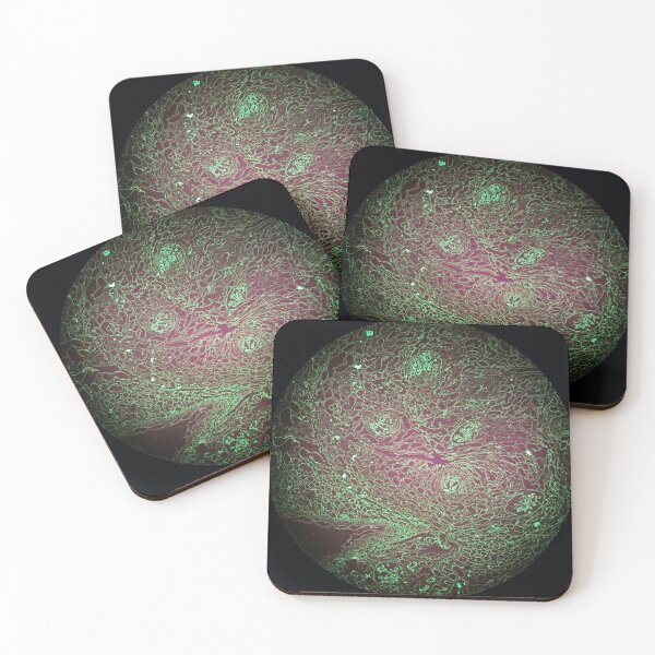 Item preview, Histology of renal tubules, immunofluorescence, 40x designed and sold by Psymier.