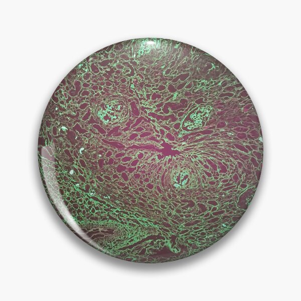 Item preview, Histology of renal tubules, immunofluorescence, 40x designed and sold by Psymier.