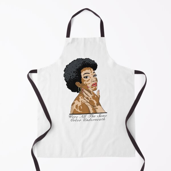 Item preview, Vitiligo Queen designed and sold by Kalanipenn.