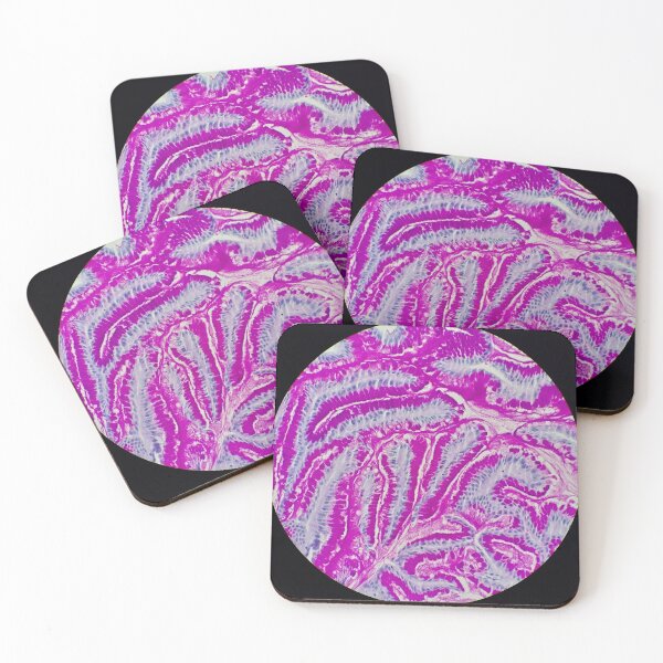 Item preview, Small bowel histology, 40x,, AB/PAS stain designed and sold by Psymier.