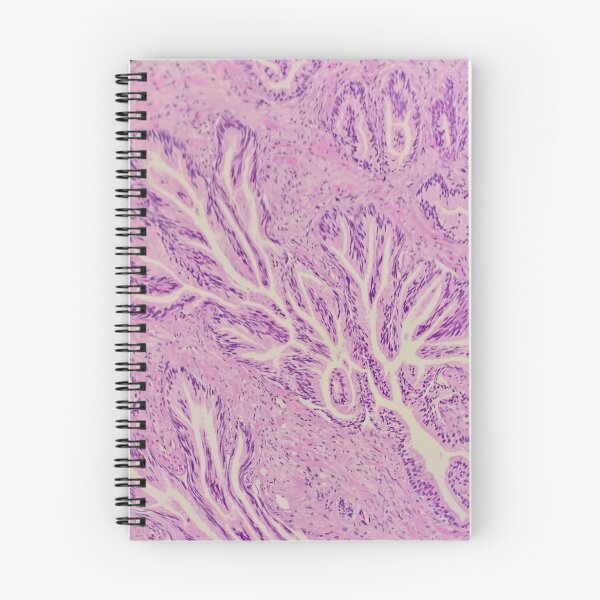 Item preview, Endocervix histology, cauterised, H&E, 40x designed and sold by Psymier.