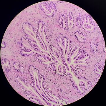 histología del endocérvix