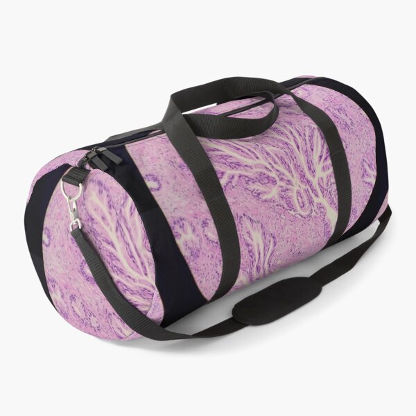 Item preview, Endocervix histology, cauterised, H&E, 40x designed and sold by Psymier.