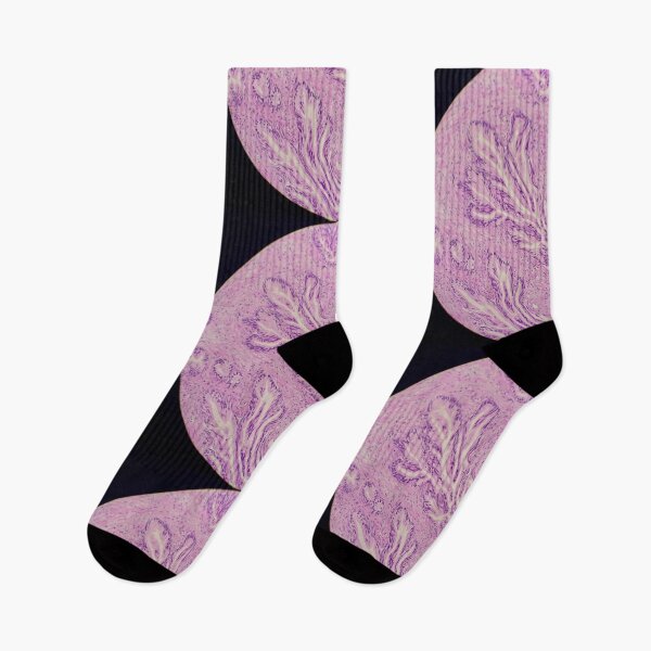 Item preview, Endocervix histology, cauterised, H&E, 40x designed and sold by Psymier.