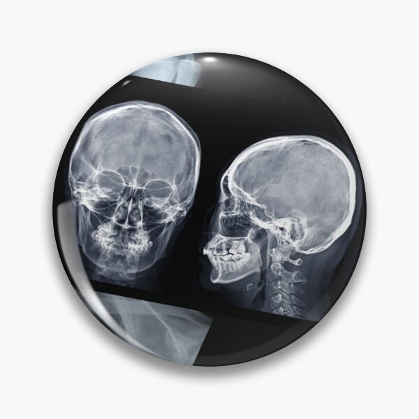 Item preview, X Ray Pattern - Human Anatomy designed and sold by alinabeska.