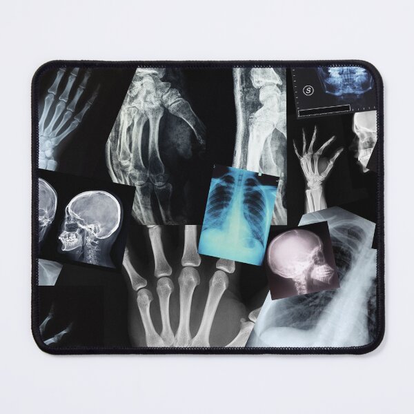 Item preview, X Ray Pattern - Human Anatomy designed and sold by alinabeska.